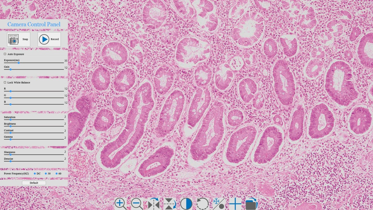 LaboQuip XCAM1080PHD, HDMI Digital Camera for Microscope CMOS, HDMI+ WiFi+ SD, Advanced& Professional with SONY Sensor + HDMI Displayer for XCAM Series Camera with Panasonic IPS LCD